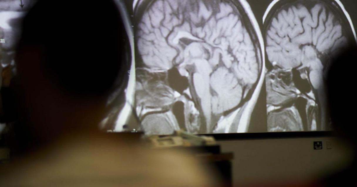 A computerised image of brains projected onto a wall.