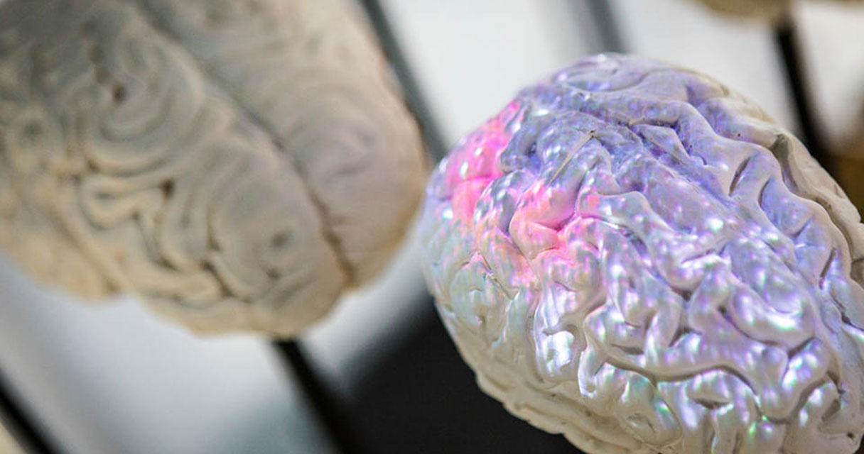 MSc Computational Cognitive Neuroscience