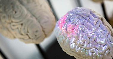 Image representing Computational Cognitive Neuroscience