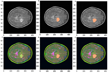 Six squares showing scans of a brain, each with different colours highlighting different parts of the brain